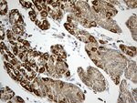 ACADM Antibody in Immunohistochemistry (Paraffin) (IHC (P))
