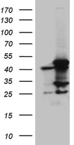 ACADM Antibody in Western Blot (WB)