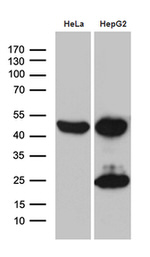 ACADM Antibody in Western Blot (WB)