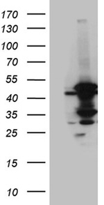 ACADM Antibody in Western Blot (WB)