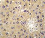 ACAT1 Antibody in Immunohistochemistry (IHC)
