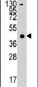 ACAT1 Antibody in Western Blot (WB)
