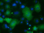ACAT2 Antibody in Immunocytochemistry (ICC/IF)