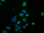 ACAT2 Antibody in Immunocytochemistry (ICC/IF)