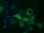 ACAT2 Antibody in Immunocytochemistry (ICC/IF)