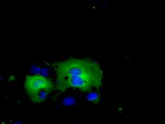 ACAT2 Antibody in Immunocytochemistry (ICC/IF)