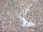 ACAT2 Antibody in Immunohistochemistry (Paraffin) (IHC (P))