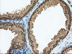 ACAT2 Antibody in Immunohistochemistry (Paraffin) (IHC (P))