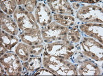 ACAT2 Antibody in Immunohistochemistry (Paraffin) (IHC (P))