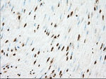 ACAT2 Antibody in Immunohistochemistry (Paraffin) (IHC (P))