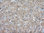 ACAT2 Antibody in Immunohistochemistry (Paraffin) (IHC (P))