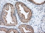 ACAT2 Antibody in Immunohistochemistry (Paraffin) (IHC (P))