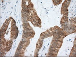 ACAT2 Antibody in Immunohistochemistry (Paraffin) (IHC (P))