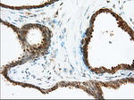 ACAT2 Antibody in Immunohistochemistry (Paraffin) (IHC (P))