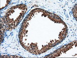ACAT2 Antibody in Immunohistochemistry (Paraffin) (IHC (P))