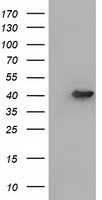 ACAT2 Antibody in Western Blot (WB)