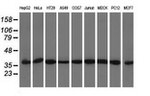 ACAT2 Antibody in Western Blot (WB)