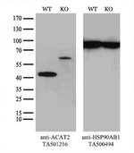ACAT2 Antibody in Western Blot (WB)