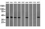 ACAT2 Antibody in Western Blot (WB)