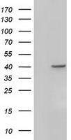 ACAT2 Antibody in Western Blot (WB)
