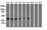 ACAT2 Antibody in Western Blot (WB)