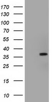 ACAT2 Antibody in Western Blot (WB)