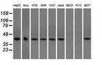 ACAT2 Antibody in Western Blot (WB)