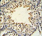 ACSBG2 Antibody in Immunohistochemistry (IHC)