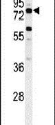 ACSBG2 Antibody in Western Blot (WB)