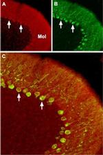 CACNA1B (CaV2.2) Antibody in Immunohistochemistry (IHC)