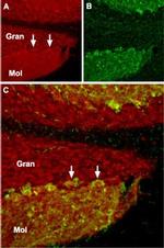 TRPC1 Polyclonal Antibody
