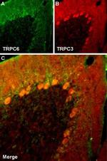 TRPC6 Antibody in Multiplex Immunohistochemistry (mIHC)