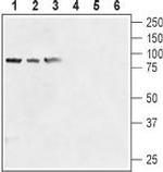 TRPV6 (extracellular) Antibody in Western Blot (WB)