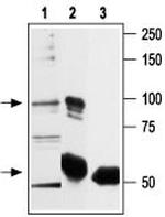 TRPV2 (VRL1) Antibody in Immunoprecipitation (IP)