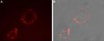 TRPV3 (extracellular) Antibody in Immunocytochemistry (ICC/IF)