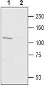 TRPV3 (extracellular) Polyclonal Antibody, Biotin