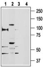 TRPV5 Antibody in Western Blot (WB)
