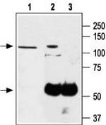 TRPA1 (extracellular) Antibody in Immunoprecipitation (IP)