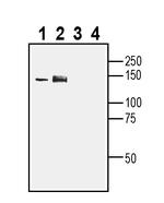 TRPA1 (extracellular) Antibody in Western Blot (WB)