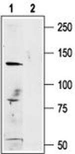 TRPM1 Polyclonal Antibody