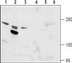 TRPM6 (extracellular) Antibody in Western Blot (WB)