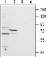 TPCN1 Antibody in Western Blot (WB)