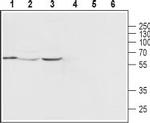 TRPML2 (Mucolipin-2) Antibody in Western Blot (WB)