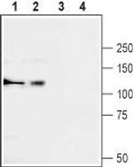 CACNA2D3 (CaV alpha 2 delta 3) (extracellular) Antibody in Western Blot (WB)