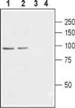 CACNB2 Antibody in Western Blot (WB)