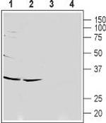 CACNG7 (extracellular) Antibody in Western Blot (WB)