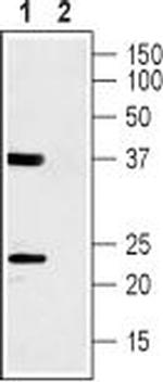 CACNG1 (extracellular) Antibody in Western Blot (WB)