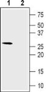 CACNG6 (extracellular) Antibody in Western Blot (WB)