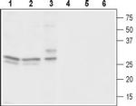 CACNG3 Antibody in Western Blot (WB)