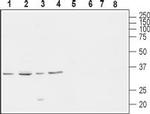 CACNG4 Polyclonal Antibody